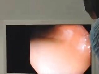 Asian female endoscopy2 - ThisVid.com